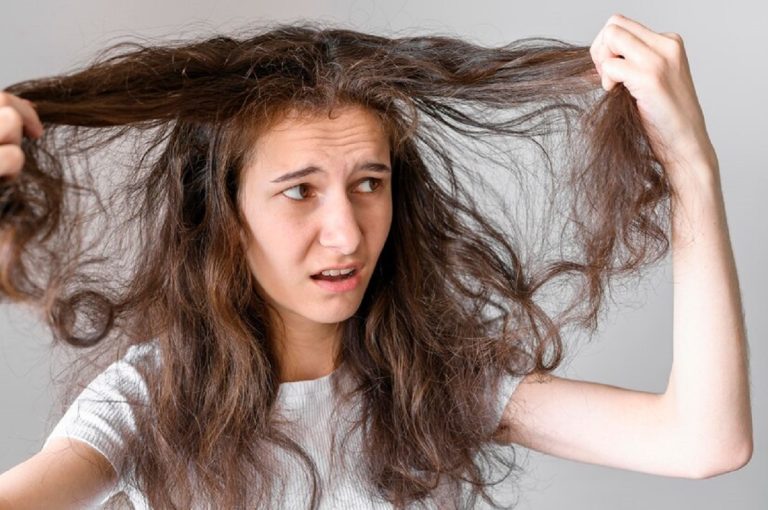 chute de cheveux