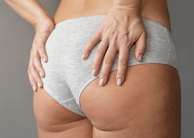 jai perdu toute ma cellulite